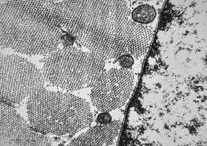 F,32y. | transversally sectioned skeletal muscle cell F,32y. | transversally sectioned skeletal muscle cell